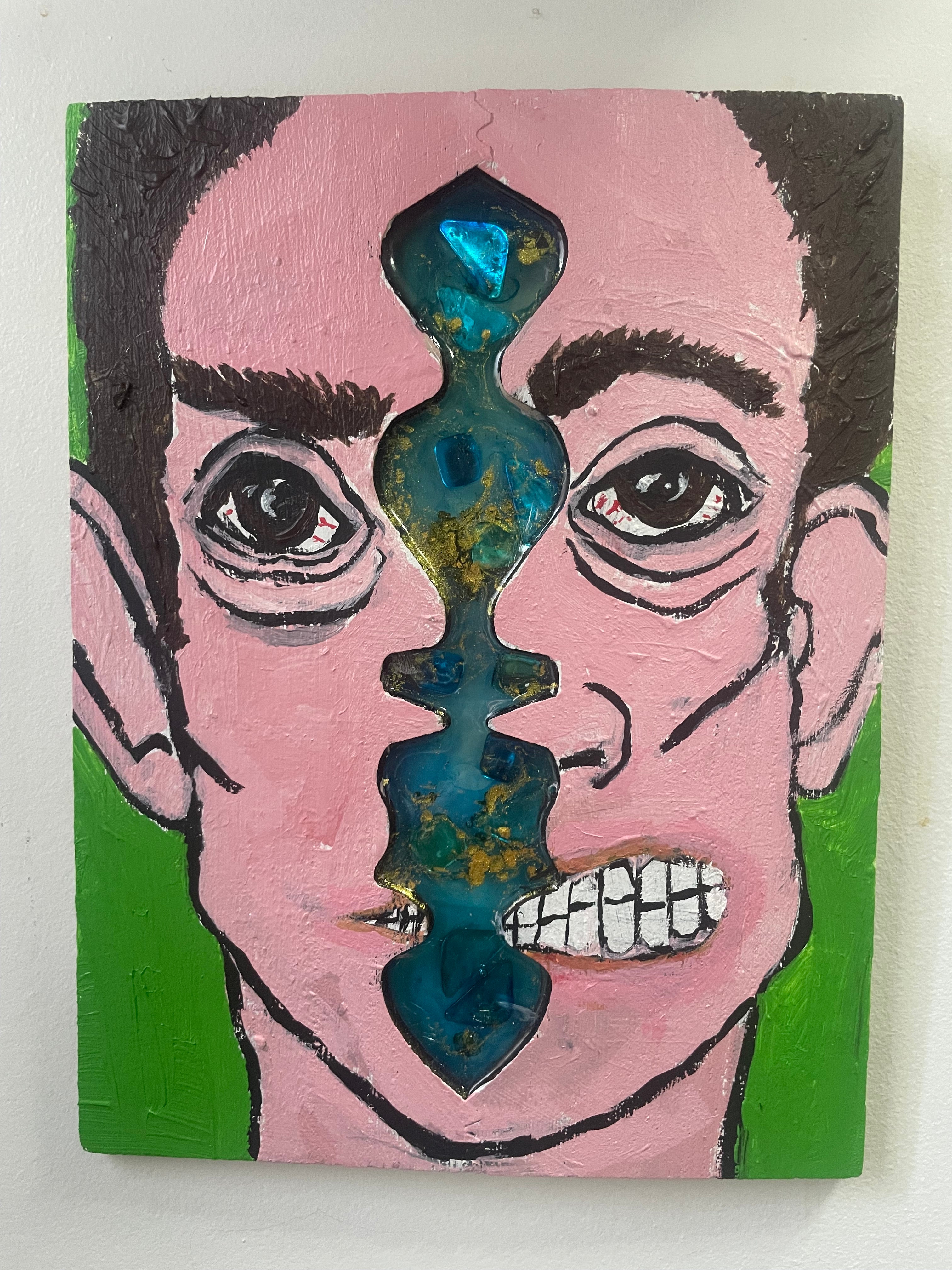 Typhoid Brian